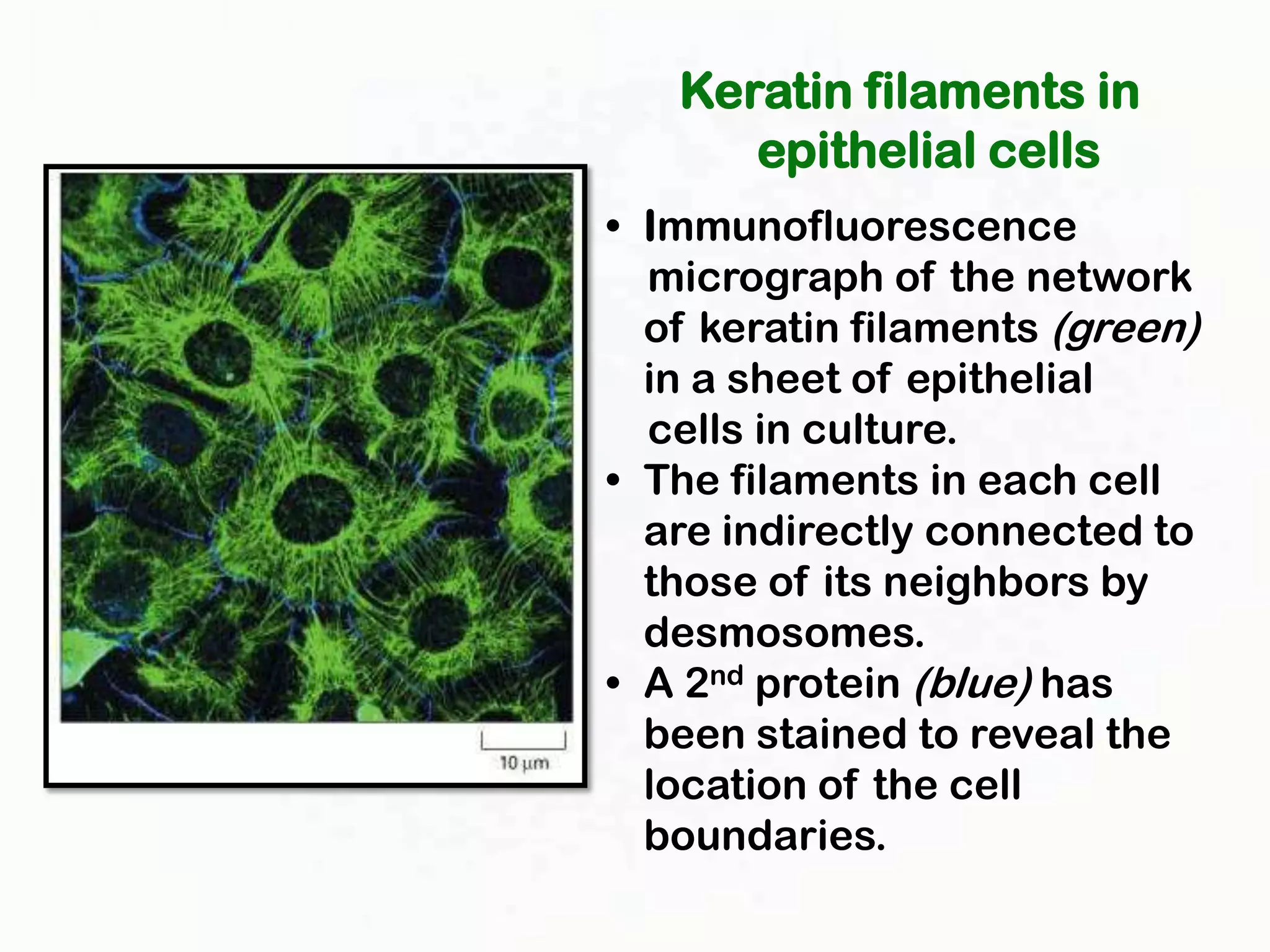 Keratin filaments in
      epithelial cells
• Immunofluorescence
  micrograph of the network
  of keratin filaments (green)
  in a sheet of epithelial
  cells in culture.
• The filaments in each cell
  are indirectly connected to
  those of its neighbors by
  desmosomes.
• A 2nd protein (blue) has
  been stained to reveal the
  location of the cell
  boundaries.
 