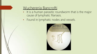 Wuchereria Bancrofti
• It is a human parasitic roundworm that is the major
cause of lymphatic filariasis.
• Found in lymphatic nodes and vessels.