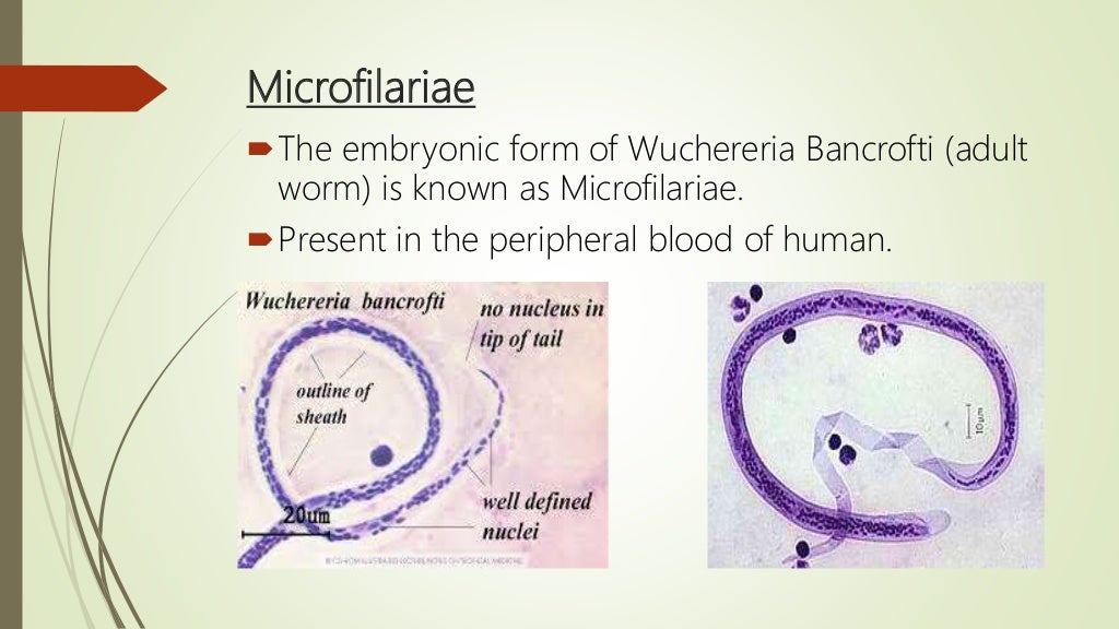 Microfilariae (Wuchereria Bancrofti)