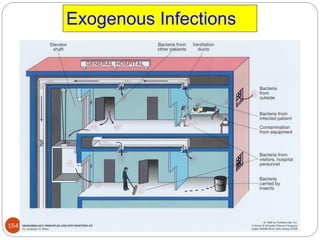 Exogenous Infections
154
 