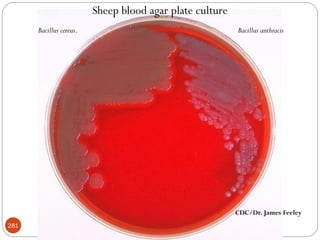 CDC/Dr. James Feeley
Sheep blood agar plate culture
Bacillus anthracis
Bacillus cereus.
281
 
