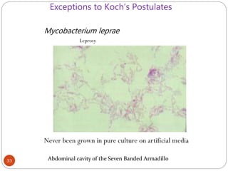 Mycobacterium leprae
Leprosy
Never been grown in pure culture on artificial media
Abdominal cavity of the Seven Banded Armadillo
Exceptions to Koch’s Postulates
33
 
