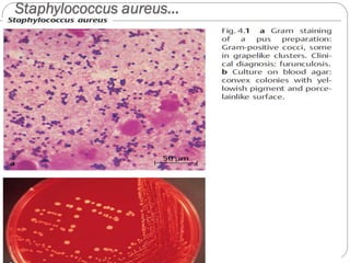Staphylococcus aureus…
343
 
