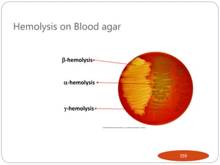 Hemolysis on Blood agar
359
-hemolysis
-hemolysis
-hemolysis
 