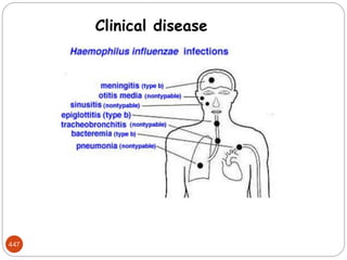 447
Clinical disease
 