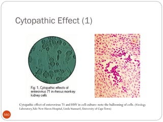 Cytopathic Effect (1)
560
Cytopathic effect of enterovirus 71 and HSV in cell culture: note the ballooning of cells. (Virology
Laboratory,Yale-New Haven Hospital, Linda Stannard, University of CapeTown)
 