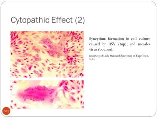 Cytopathic Effect (2)
561
Syncytium formation in cell culture
caused by RSV (top), and measles
virus (bottom).
(courtesy of Linda Stannard, University of CapeTown,
S.A.)
 
