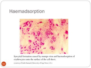 Haemadsorption
562
Syncytial formation caused by mumps virus and haemadsorption of
erythrocytes onto the surface of the cell sheet.
(courtesy of Linda Stannard, University of CapeTown, S.A.)
 
