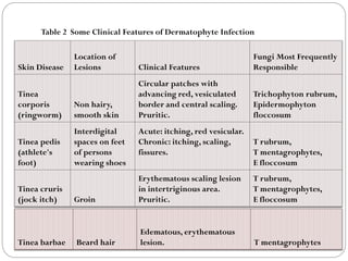 661
Skin Disease
Location of
Lesions Clinical Features
Fungi Most Frequently
Responsible
Tinea
corporis
(ringworm)
Non hairy,
smooth skin
Circular patches with
advancing red, vesiculated
border and central scaling.
Pruritic.
Trichophyton rubrum,
Epidermophyton
floccosum
Tinea pedis
(athlete's
foot)
Interdigital
spaces on feet
of persons
wearing shoes
Acute: itching, red vesicular.
Chronic: itching, scaling,
fissures.
T rubrum,
T mentagrophytes,
E floccosum
Tinea cruris
(jock itch) Groin
Erythematous scaling lesion
in intertriginous area.
Pruritic.
T rubrum,
T mentagrophytes,
E floccosum
Table 2 Some Clinical Features of Dermatophyte Infection
Tinea barbae Beard hair
Edematous, erythematous
lesion. T mentagrophytes
 