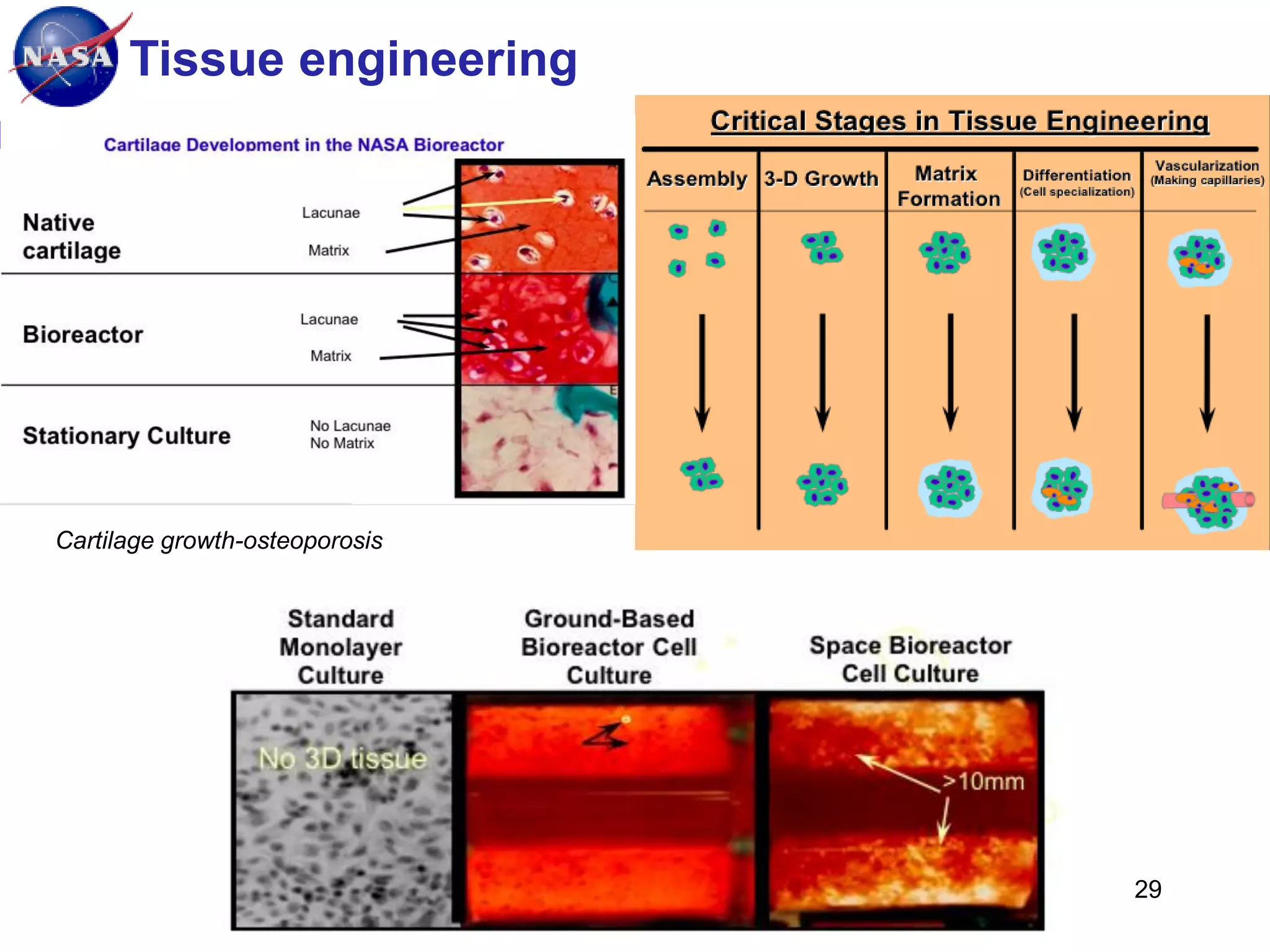 Tissue engineering
Ames Research Center, Space Portal/Emerging Space Office

STC

Cartilage growth-osteoporosis

29

 