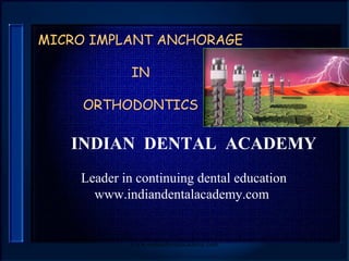 MICRO IMPLANT ANCHORAGE
IN
ORTHODONTICS

INDIAN DENTAL ACADEMY
Leader in continuing dental education
www.indiandentalacademy.com

www.indiandentalacademy.com

 