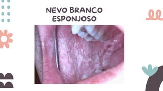 NEVO BRANCO
ESPONJOSO
 