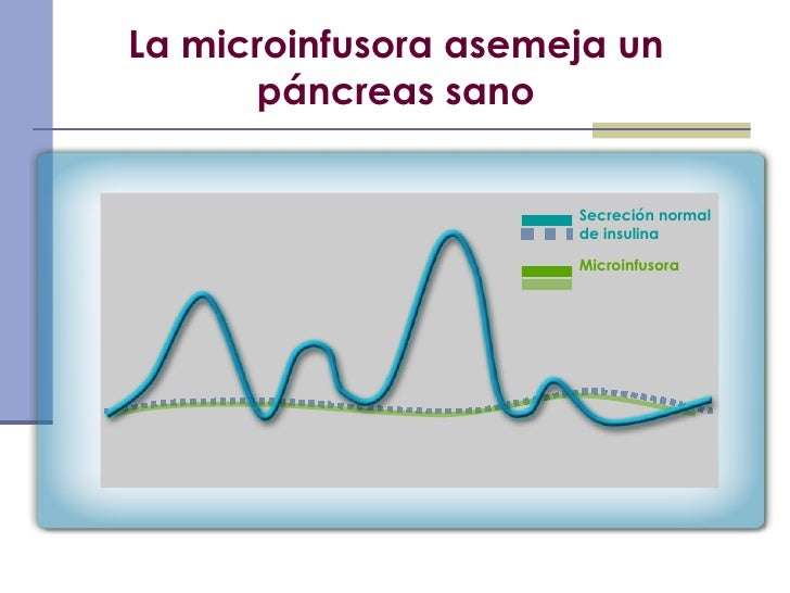 Microinfusoras De Insulina Microinfusoras De Insulina