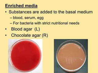 Enriched media
• Substances are added to the basal medium
– blood, serum, egg
– For bacteria with strict nutritional needs
• Blood agar (L)
• Chocolate agar (R)
 