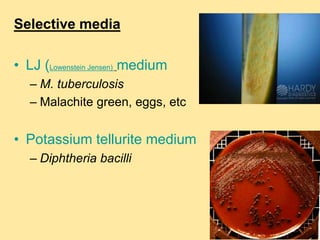 Selective media
• LJ (Lowenstein Jensen) medium
– M. tuberculosis
– Malachite green, eggs, etc
• Potassium tellurite medium
– Diphtheria bacilli
 