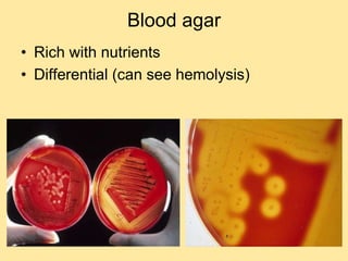 Blood agar
• Rich with nutrients
• Differential (can see hemolysis)
 