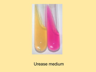 Urease medium
 