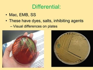 Differential:
• Mac, EMB, SS
• These have dyes, salts, inhibiting agents
– Visual differences on plates
 