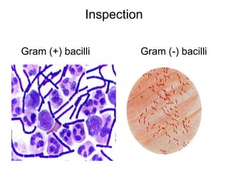 Inspection
Gram (+) bacilli Gram (-) bacilli
 