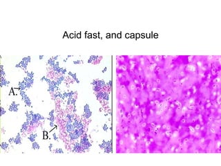 Acid fast, and capsule
 