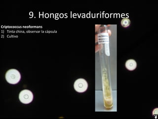 9. Hongos levaduriformes
Criptococcus neoformans
1) Tinta china, observar la cápsula
2) Cultivo
 