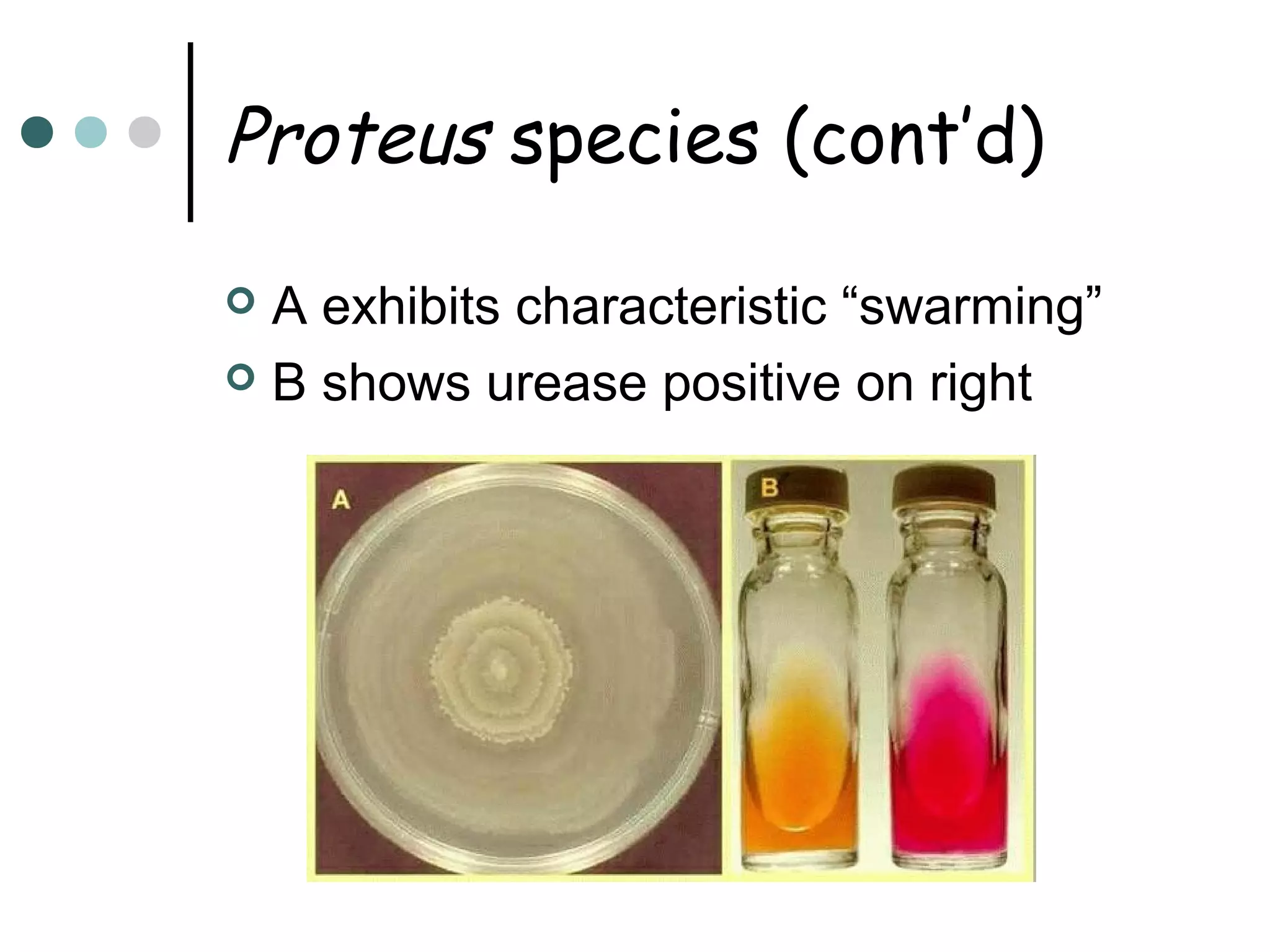 Proteus species (cont’d)
A exhibits characteristic “swarming”
 B shows urease positive on right


 