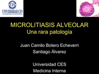 MICROLITIASIS ALVEOLAR
Una rara patología
Juan Camilo Botero Echeverri
Santiago Álvarez
Universidad CES
Medicina Interna
 