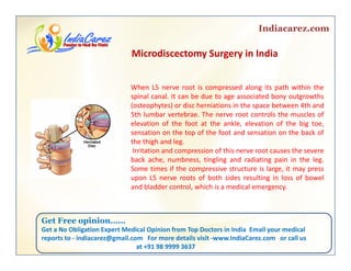 Indiacarez.com
Mi di S i I diMicrodiscectomy Surgery in India 
When L5 nerve root is compressed along its path within the
spinal canal. It can be due to age associated bony outgrowths
(osteophytes) or disc herniations in the space between 4th and
5th lumbar vertebrae. The nerve root controls the muscles of
elevation of the foot at the ankle, elevation of the big toe,
sensation on the top of the foot and sensation on the back of
the thigh and leg.
Irritation and compression of this nerve root causes the severeIrritation and compression of this nerve root causes the severe
back ache, numbness, tingling and radiating pain in the leg.
Some times if the compressive structure is large, it may press
upon L5 nerve roots of both sides resulting in loss of bowel
and bladder control which is a medical emergencyand bladder control, which is a medical emergency.
Get Free opinionGet Free opinion……
Get a No Obligation Expert Medical Opinion from Top Doctors in India  Email your medical 
reports to ‐ indiacarez@gmail.com   For more details visit ‐www.IndiaCarez.com   or call us 
at +91 98 9999 3637
 