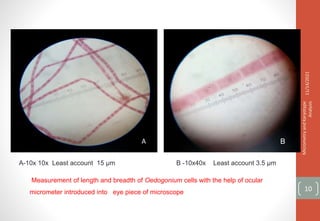B
D F
A-10x 10x Least account 15 µm B -10x40x Least account 3.5 µm
Measurement of length and breadth of Oedogonium cells with the help of ocular
micrometer introduced into eye piece of microscope
C D
A
11/14/2021
Micrometry
and
Karyotype
Analysis
10
 