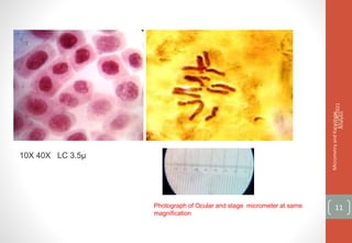 10X 40X LC 3.5µ
11/14/2021
Micrometry
and
Karyotype
Analysis
11
Photograph of Ocular and stage micrometer at same
magnification
 
