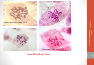 Metaphase Allium cepa 2n=16
Metaphase Vicia faba 2n=12
11/14/2021
Micrometry
and
Karyotype
Analysis
34
Some Metaphase Plates
 