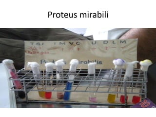 Proteus mirabili<br />