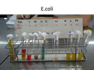 E.coli<br />