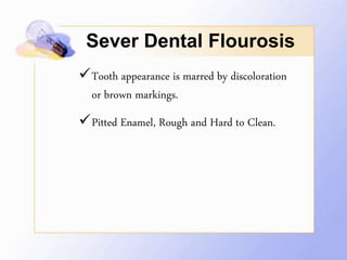 Tooth appearance is marred by discoloration
or brown markings.
Pitted Enamel, Rough and Hard to Clean.
Sever Dental Flourosis
 