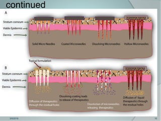 Microneedles in Transdermal Drug Delivery System | PPTX