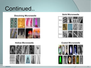 Microneedles in Transdermal Drug Delivery System | PPTX