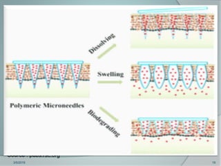 Microneedles in Transdermal Drug Delivery System | PPTX