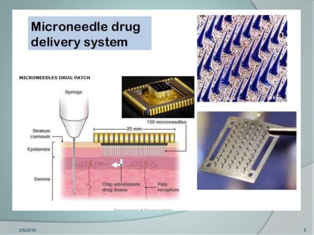 Microneedles in Transdermal Drug Delivery System | PPTX