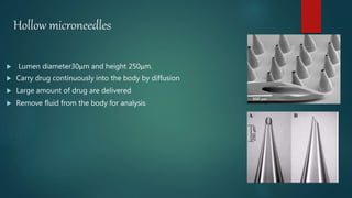 Microneedles | PPTX