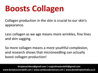 Boosts Collagen
Collagen production in the skin is crucial to our skin’s
appearance.
Less collagen as we age means more wrinkles, fine lines
and skin sagging.
So more collagen means a more youthful complexion,
and research shows that microneedling can actually
boost collagen production!
 