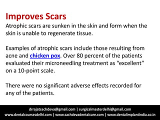 Improves Scars
Atrophic scars are sunken in the skin and form when the
skin is unable to regenerate tissue.
Examples of atrophic scars include those resulting from
acne and chicken pox. Over 80 percent of the patients
evaluated their microneedling treatment as “excellent”
on a 10-point scale.
There were no significant adverse effects recorded for
any of the patients.
 