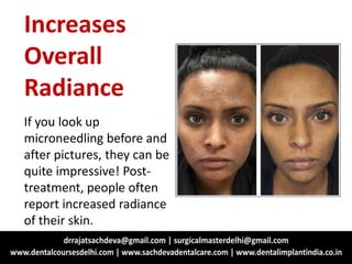 Increases
Overall
Radiance
If you look up
microneedling before and
after pictures, they can be
quite impressive! Post-
treatment, people often
report increased radiance
of their skin.
 