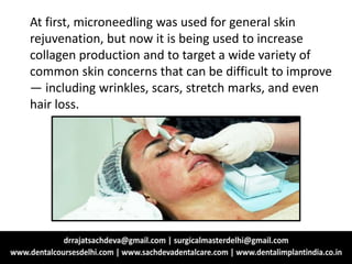 At first, microneedling was used for general skin
rejuvenation, but now it is being used to increase
collagen production and to target a wide variety of
common skin concerns that can be difficult to improve
— including wrinkles, scars, stretch marks, and even
hair loss.
 
