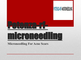 Potenza-rf-
microneedling
Microneedling For Acne Scars
 