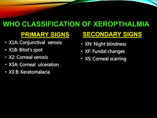 WHO CLASSIFICATION OF XEROPTHALMIA
PRIMARY SIGNS
• X1A: Conjunctival xerosis
• X1B: Bitot’s spot
• X2: Corneal xerosis
• X3A: Corneal ulceration
• X3 B: Keratomalacia
SECONDARY SIGNS
• XN: Night blindness
• XF: Fundal changes
• XS: Corneal scarring
 