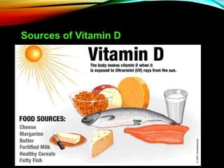 Sources of Vitamin D
 