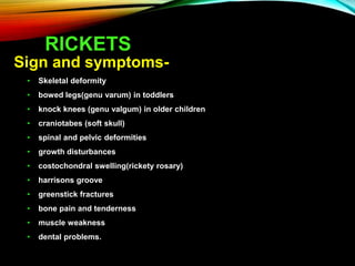 RICKETS
Sign and symptoms-
• Skeletal deformity
• bowed legs(genu varum) in toddlers
• knock knees (genu valgum) in older children
• craniotabes (soft skull)
• spinal and pelvic deformities
• growth disturbances
• costochondral swelling(rickety rosary)
• harrisons groove
• greenstick fractures
• bone pain and tenderness
• muscle weakness
• dental problems.
 