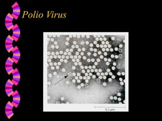 Polio Virus
 