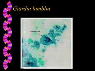 Giardia lamblia
 