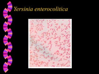 Yersinia enterocolitica
 